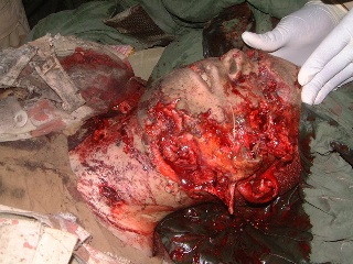 iraqcasualty