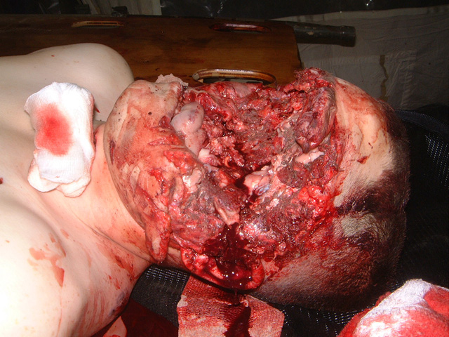 iraqcasualty2